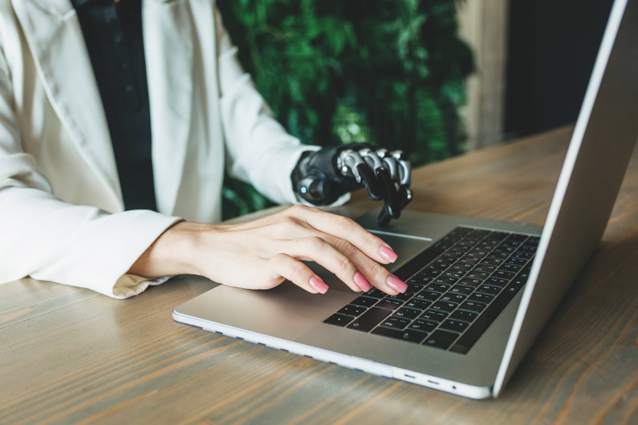Person with a prosthetic hand working on a laptop at a desk