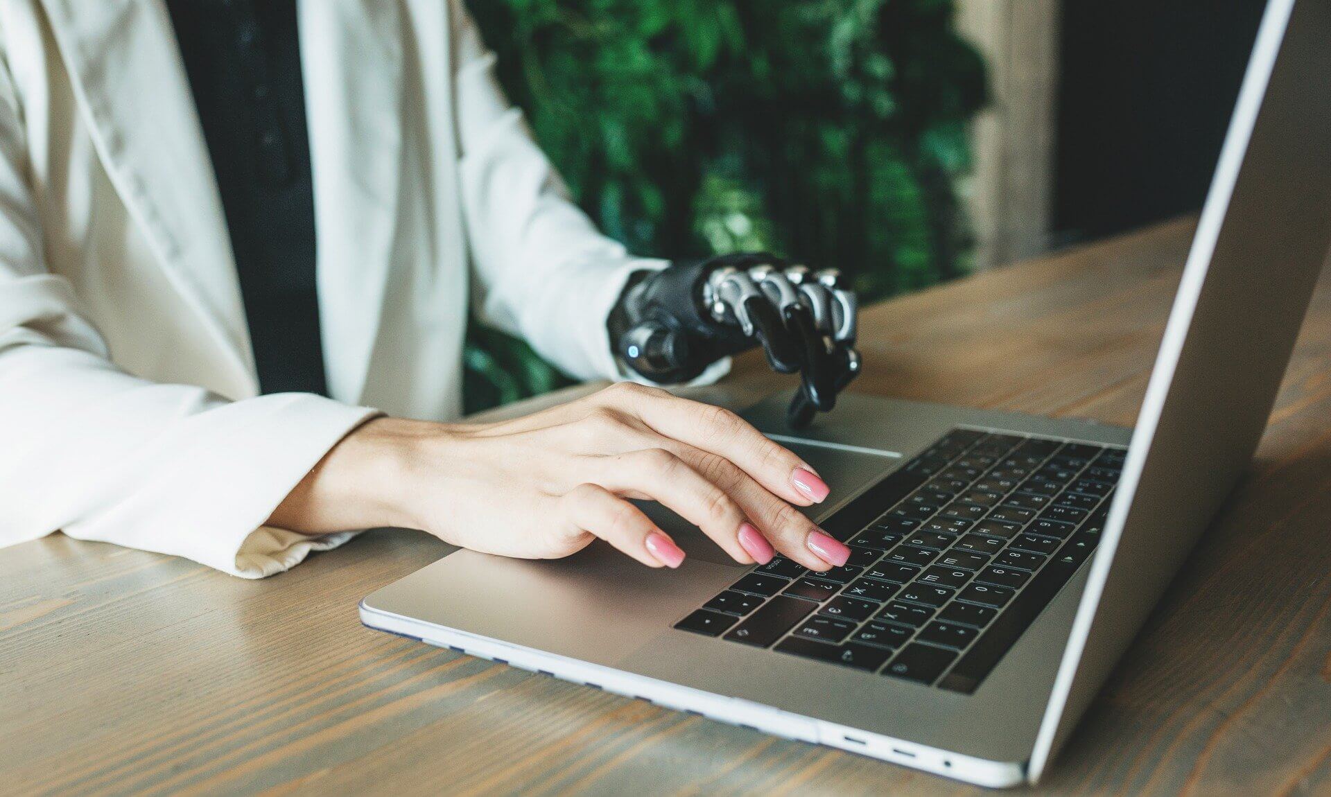 Person with a prosthetic hand working on a laptop at a desk